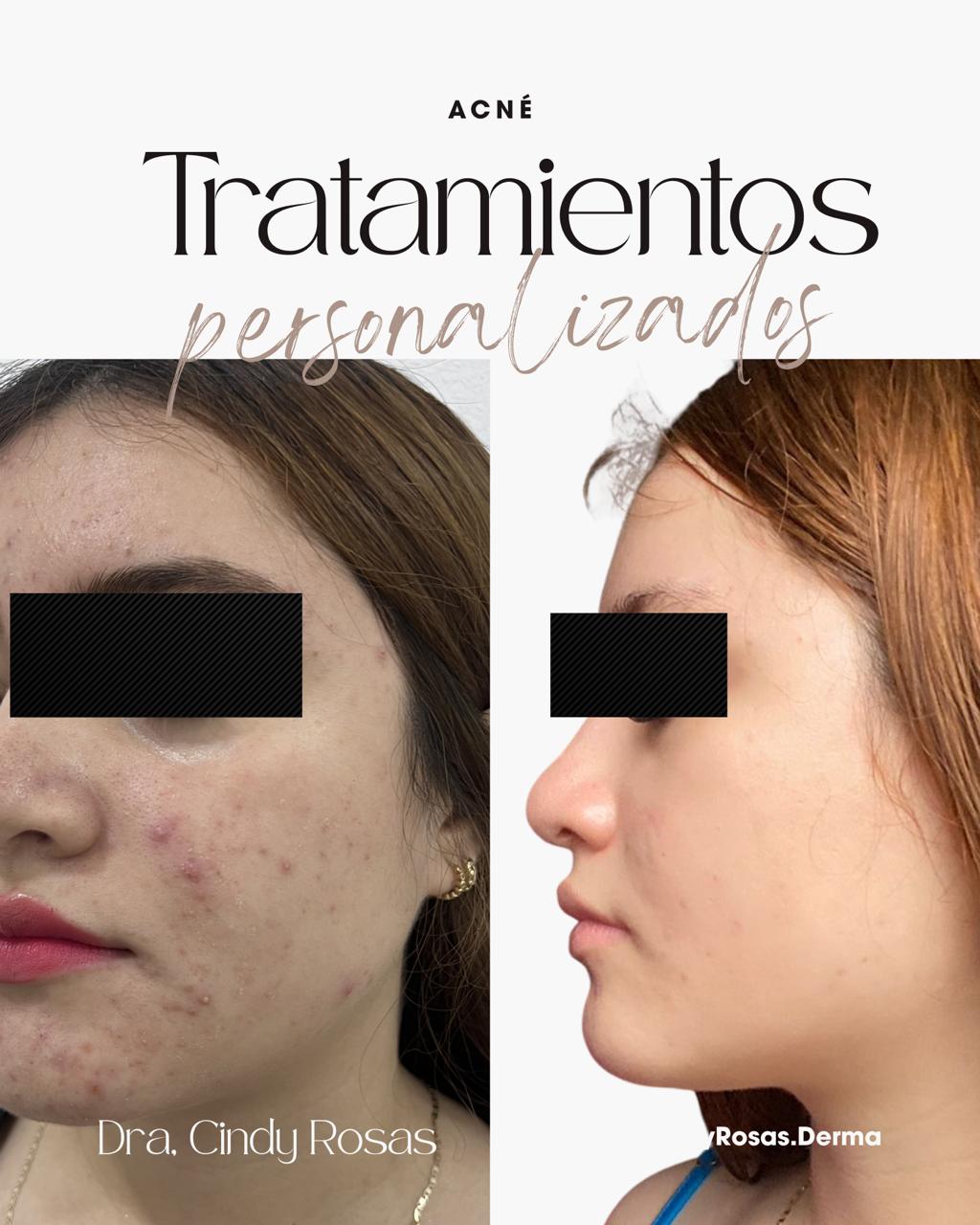 Área de tratamientos dermatológicos