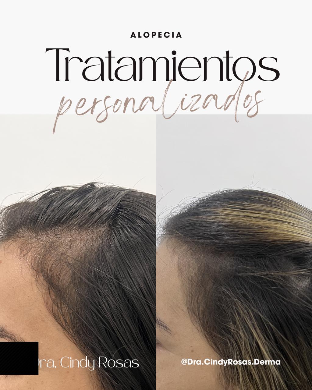 Atención personalizada dermatología